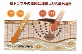 2ヵ月後にはっきり差が出る「徹底美白」3つの鉄則